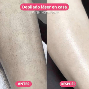 Depiladora Eléctrica Portátil e Indolora – Comodidad y Practicidad