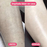 Depiladora Eléctrica Portátil e Indolora – Comodidad y Practicidad